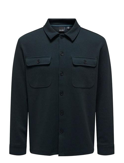 ONLY & SONS | Onsnewkodyl Overshirt Sweat Noos | S