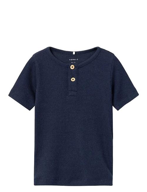 name it | Nmmkab Ss Top Noos | 86