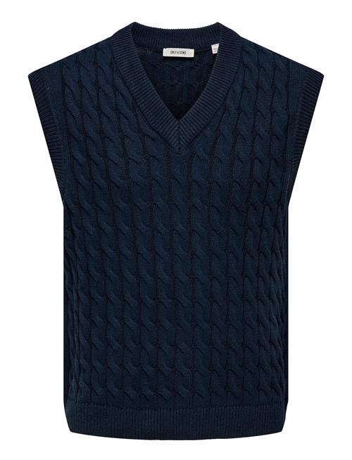 ONLY & SONS | Onskicker Life Rlx 3 Cable Vest Knit | XS