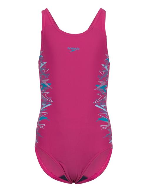 Speedo | Placement Muscleback One Piece | 140