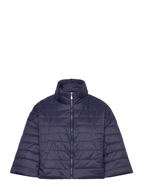 United Colors of Benetton | Jacket | XXS