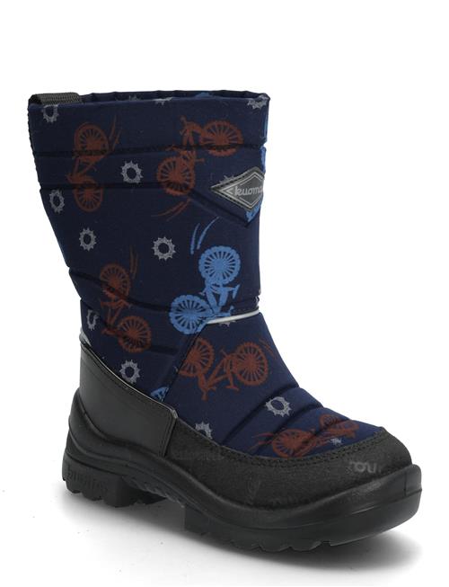 Kuoma | Putkivarsi | 30/19.6CM