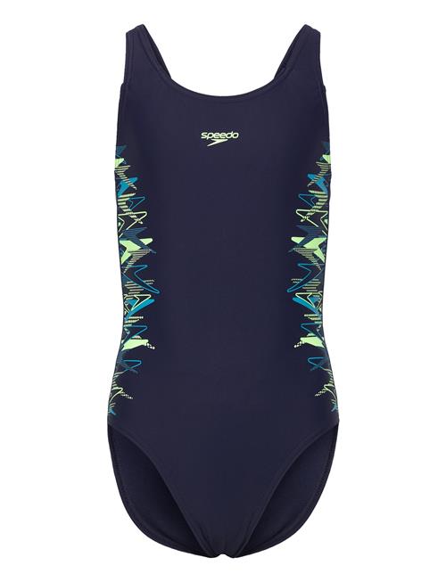 Speedo | Placement Muscleback One Piece | 152