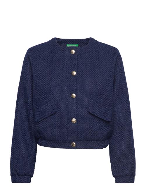 United Colors of Benetton | Jacket | 34