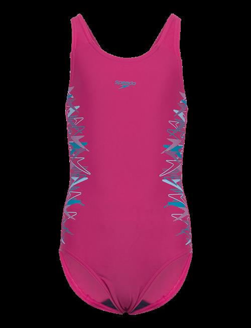 Speedo | Placement Muscleback One Piece | 152
