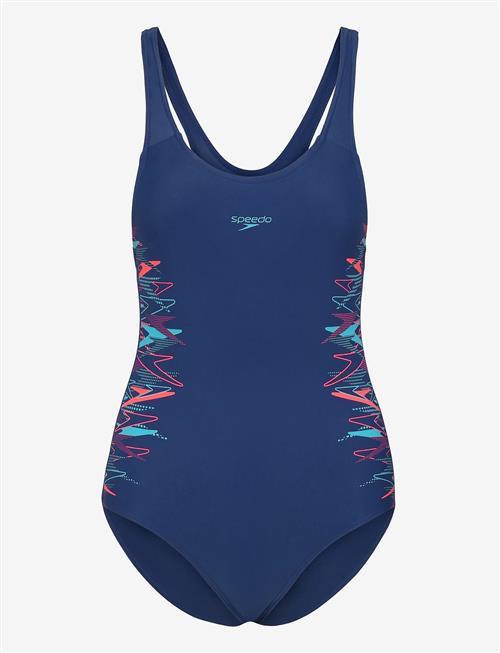 Speedo | Placement Muscleback 1Pc | 128